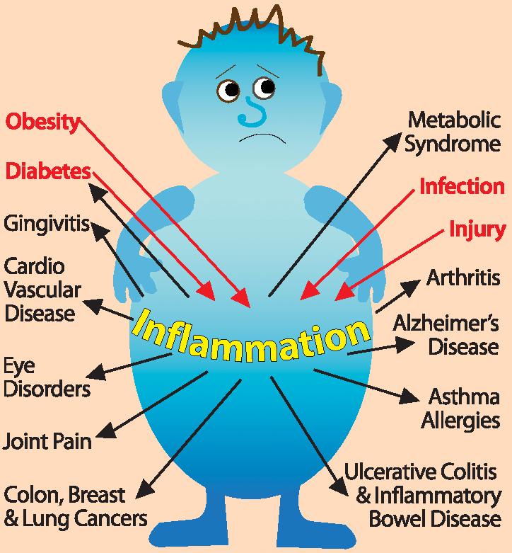 Inflammation Response